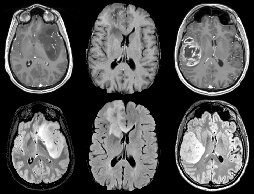 Cerveau